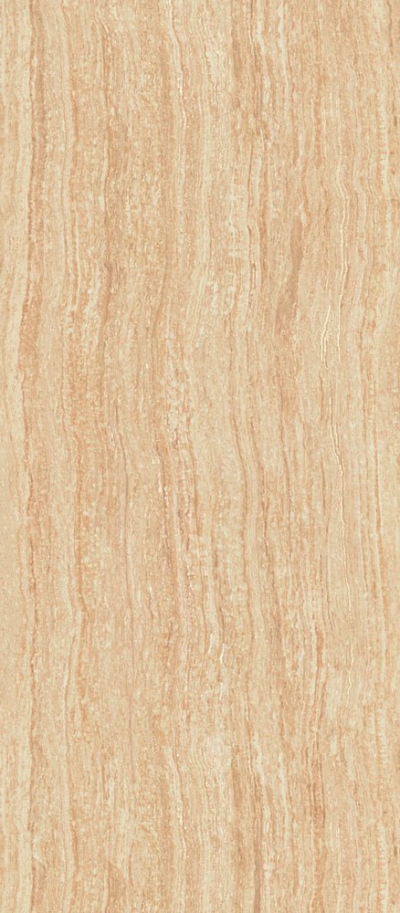 Sand Rett / Сэнд Ретт